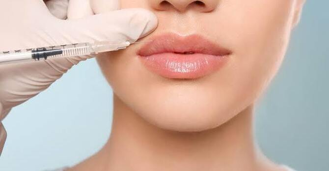 Dermal Fillers